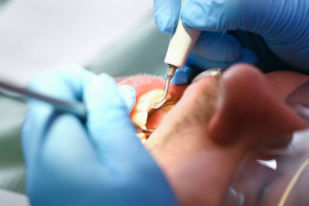 Best Emergency Treatment for Dental Infections or Abscesses in Shepherd, TX